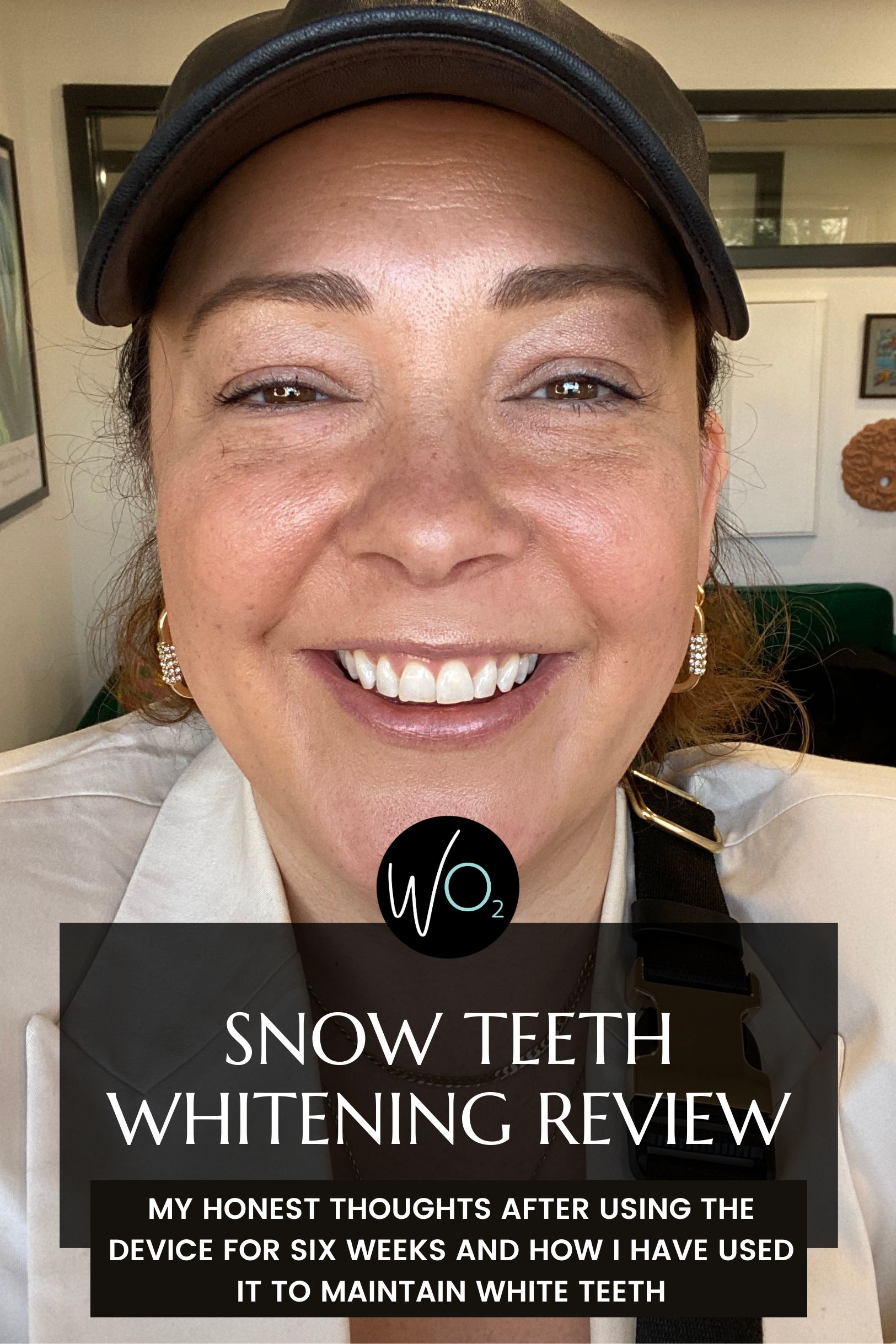 Snow Teeth Whitening Review